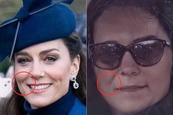 Qué le pasa realmente a Kate Middleton Te traemos las distintas