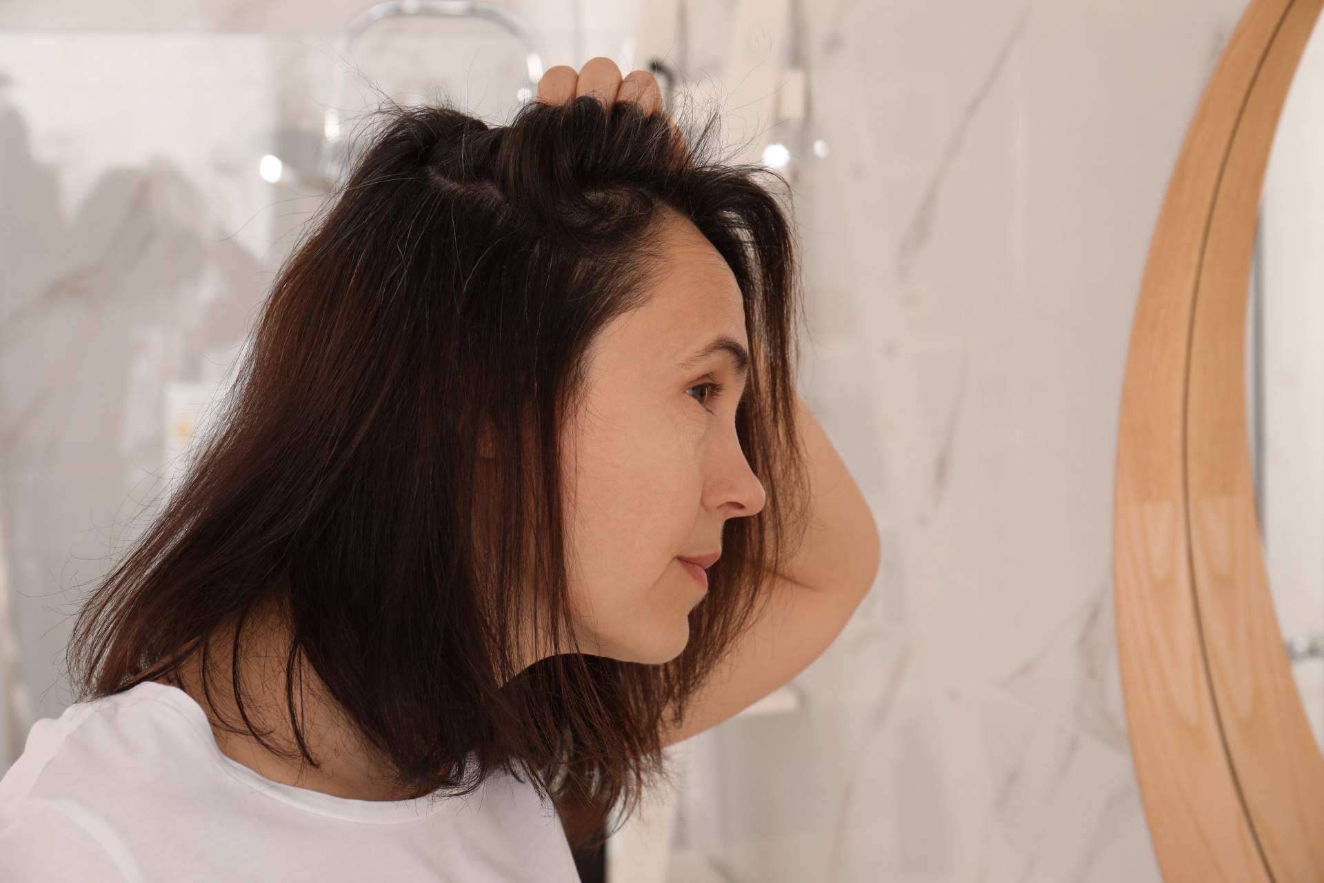 Las mujeres también sufren alopecia, por Clínica Femme