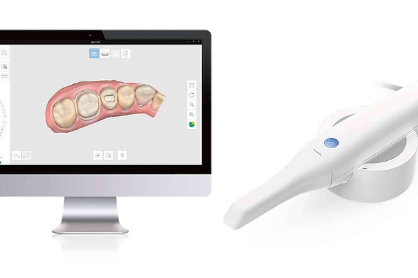 No más pastas en boca, tecnología 3D con escáner oral