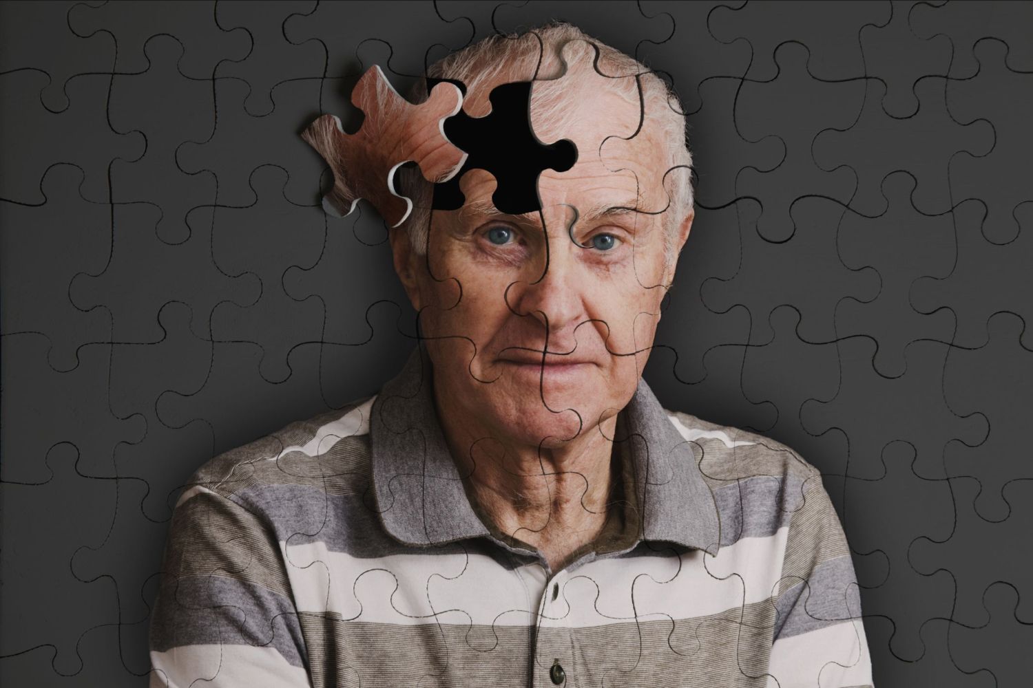 ¿Qué es el Alzheimer?