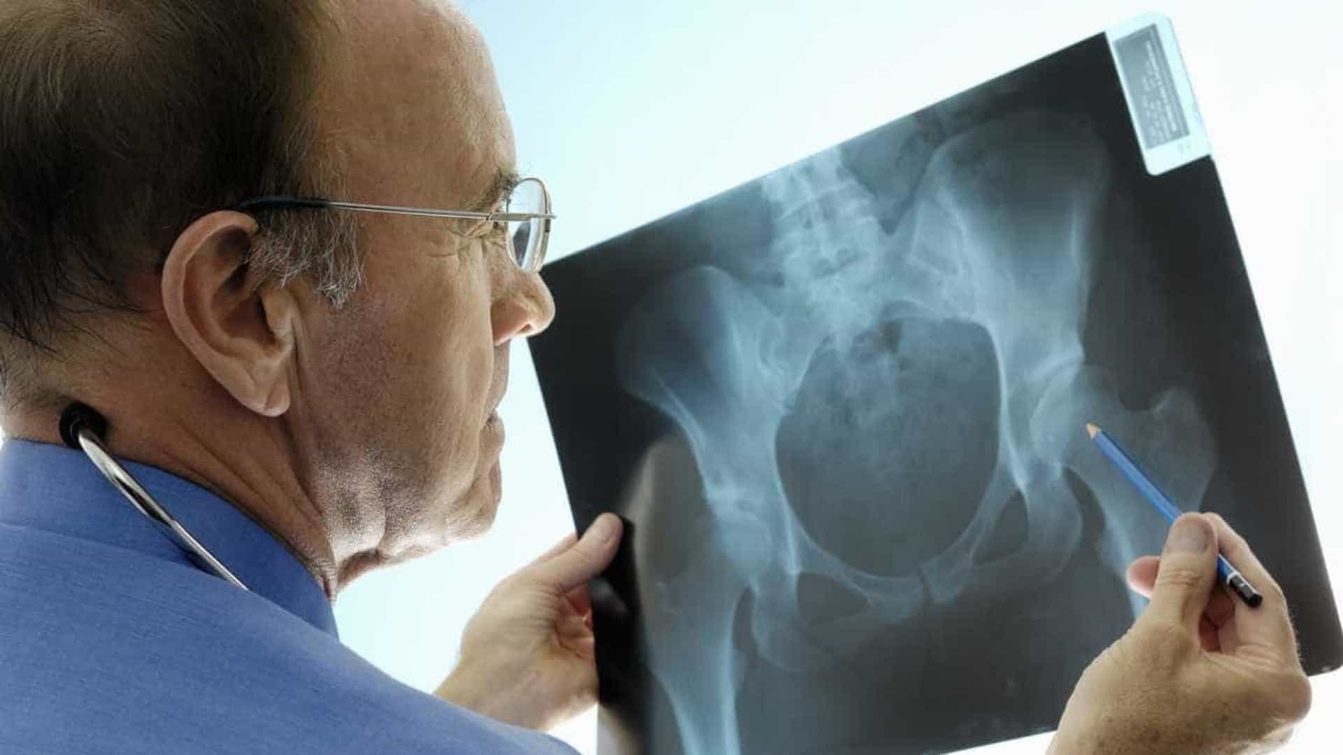 La Osteoporosis en el Contexto de las Enfermedades Crónicas