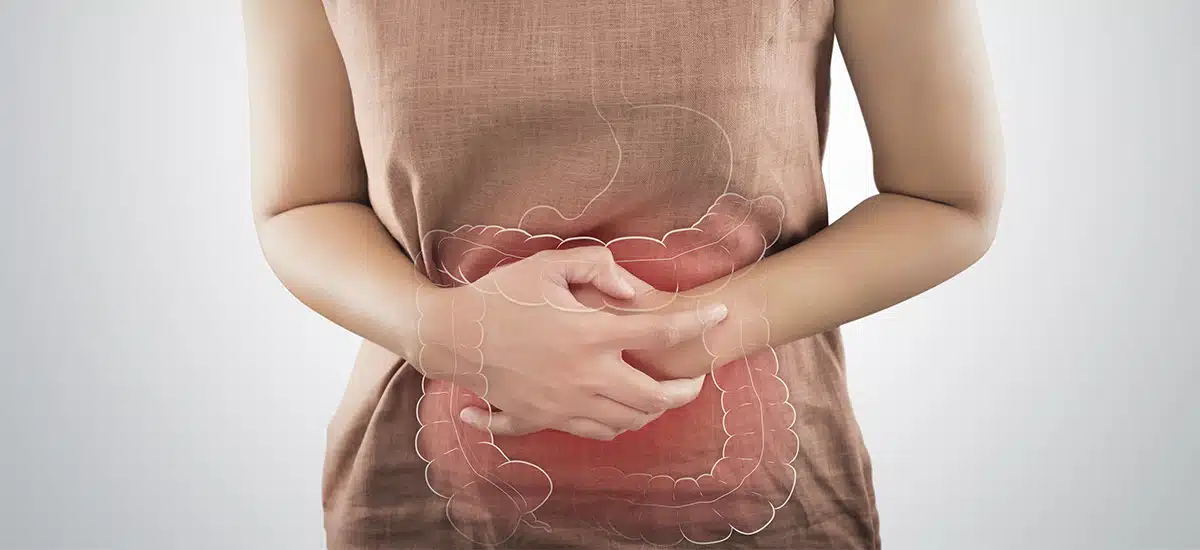 Lo que tienes que saber para prevenir el cáncer de colon