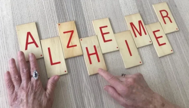 5 claves para reconocer el Alzheimer a tiempo