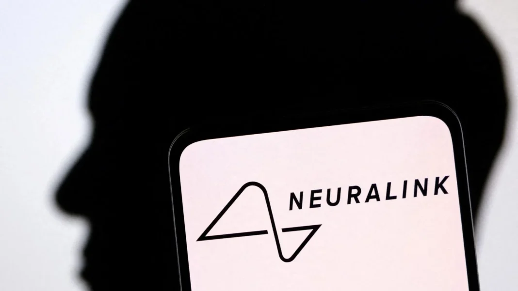 Neuralink implante