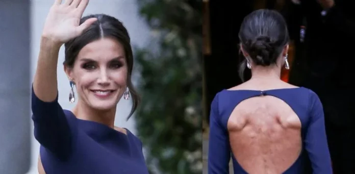 La poderosa rutina de la reina Letizia para eliminar los michelines de la espalda